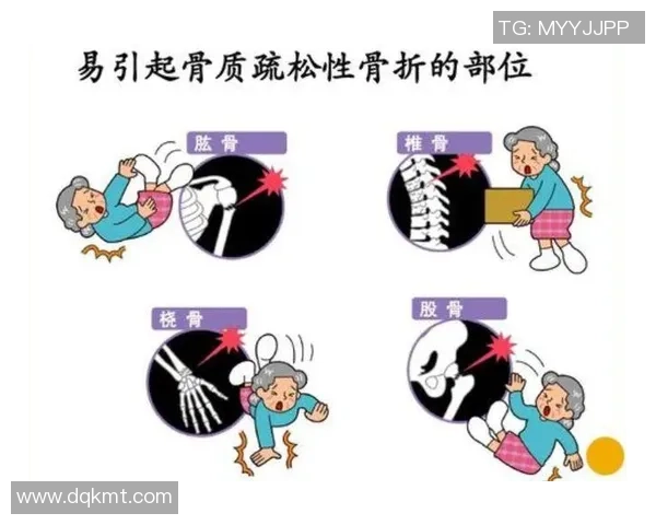 足球明星频繁骨折的原因探讨与运动伤害的深层次分析